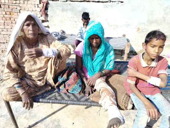 wildanimal-attackedfamily-inju